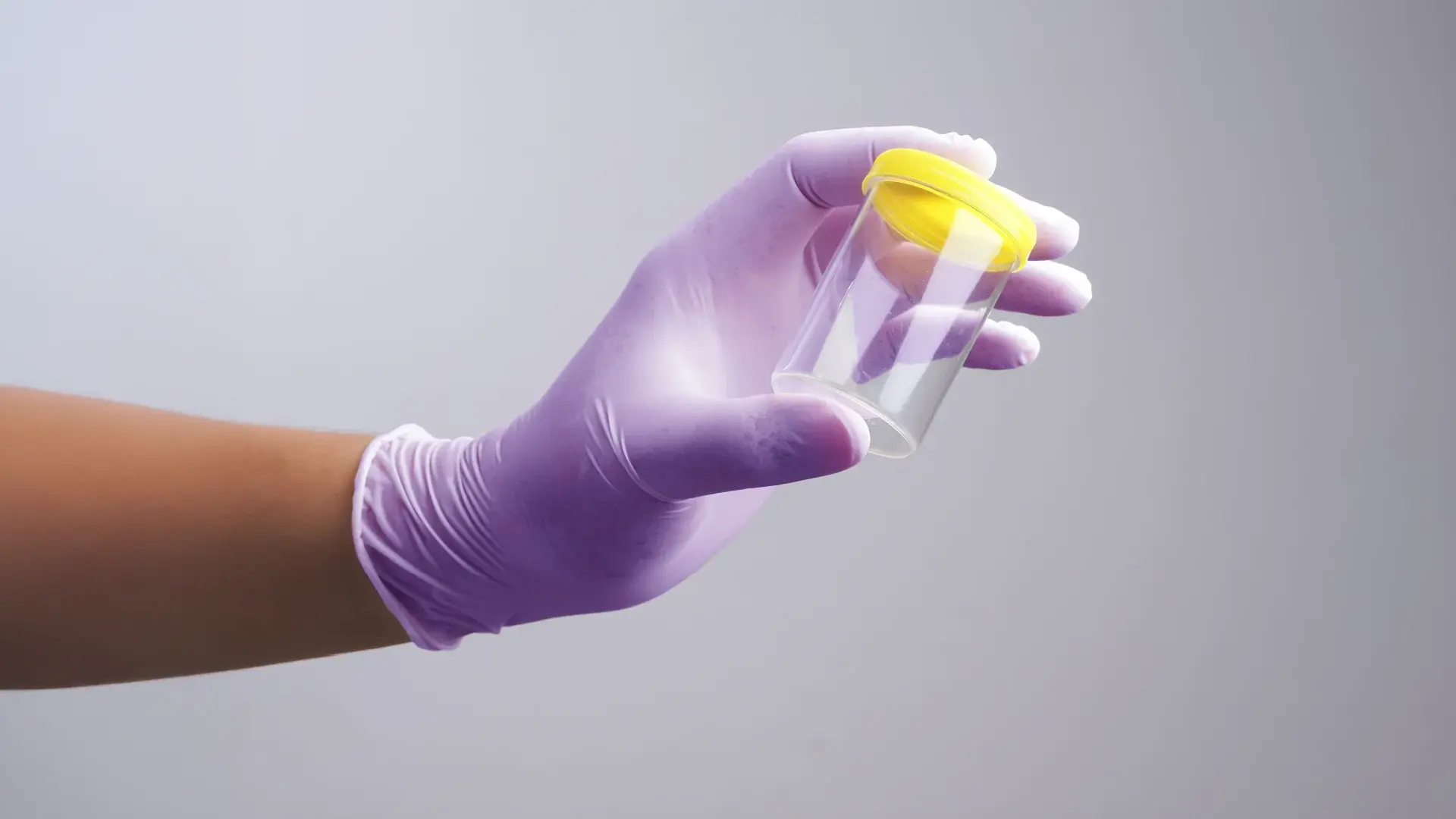 FWA Insights: Uncovering improper billing in urine drug screens